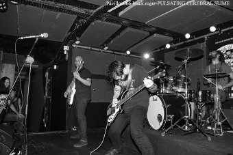 18.09.18_pulsatingcerebralslime06